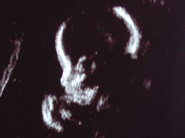 ultrasound4.jpg